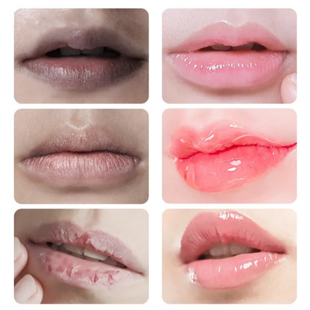 Jual Lip balm lip mask Serum bibir untuk bibir hitam Perawatan bibir ...