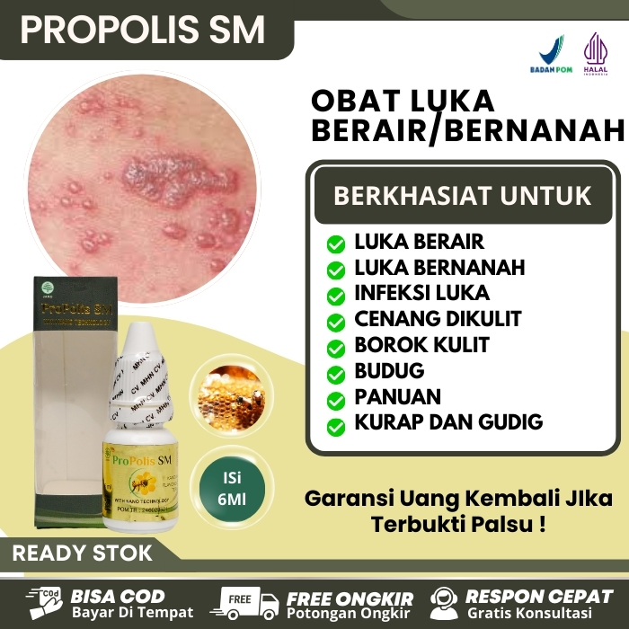 Jual Salep Untuk Gatal Berair Obat Gatal Bernanah Bruntutsan Jari