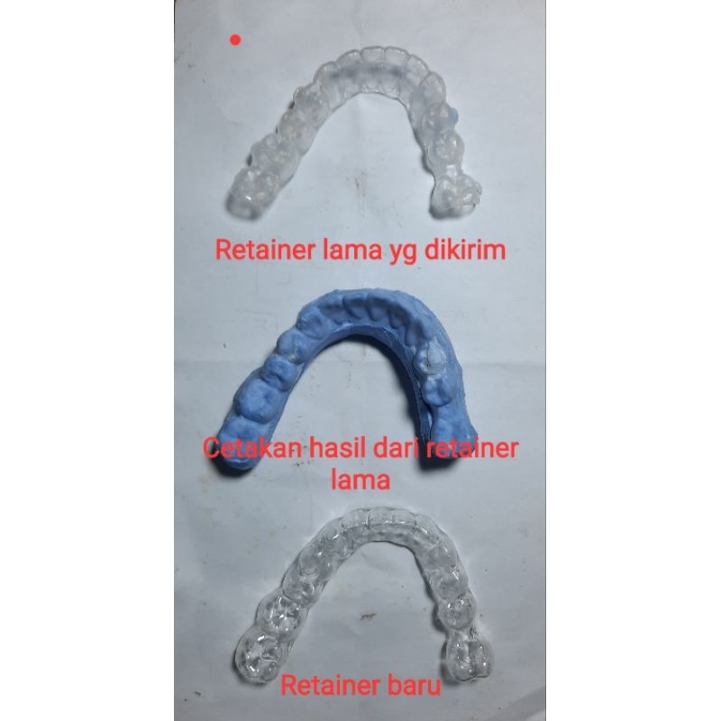 Jual Retainer Gigi Terlengkap & Harga Terbaru Agustus 2026 | Shopee ...