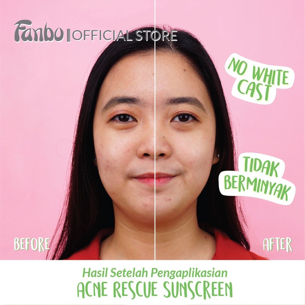 Jual Fanbo Acne Rescue Water Gel Sunscreen SPF 35 , PA++++ - untuk ...