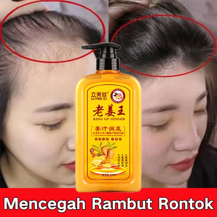 Jual Shampo Jahe Penumbuh Rambut Tebal Anti Ketombe Gatal Anti Rambut ...
