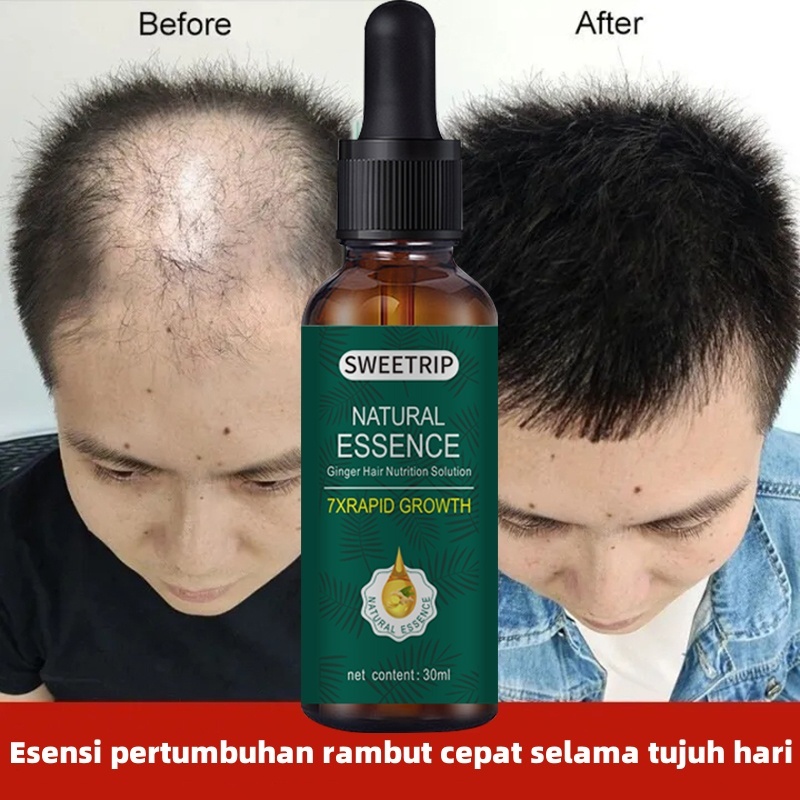 Jual Obat Penumbuh Rambut Terlengkap & Harga Terbaru Juli 2026 | Shopee ...