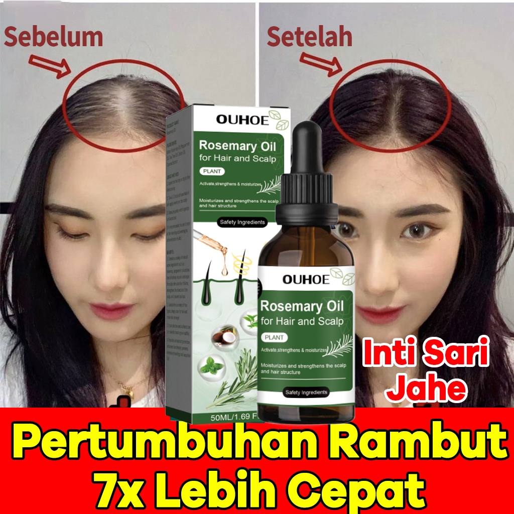 Jual Serum Penebal Rambut Rosemary Oil Hair Oil Rambut Rontok Penumbuh ...