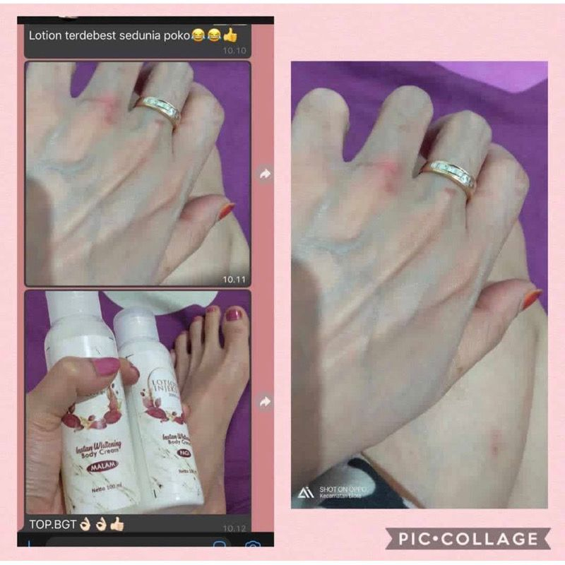Jual LOTION INJEKSI 3000GS | Shopee Indonesia