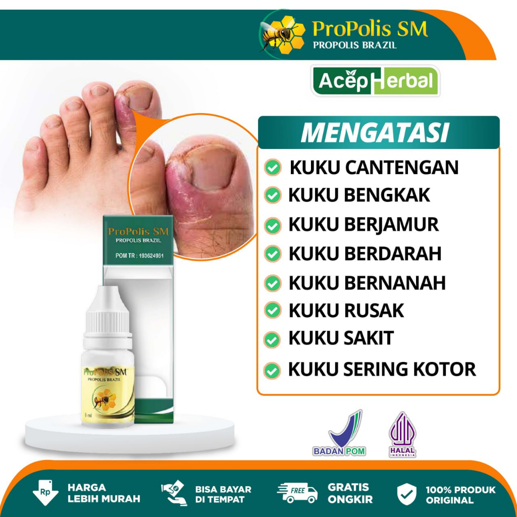 Jual Obat Cantengan Jempol Kuku Kaki Dan Tangan Menahun Cantengan