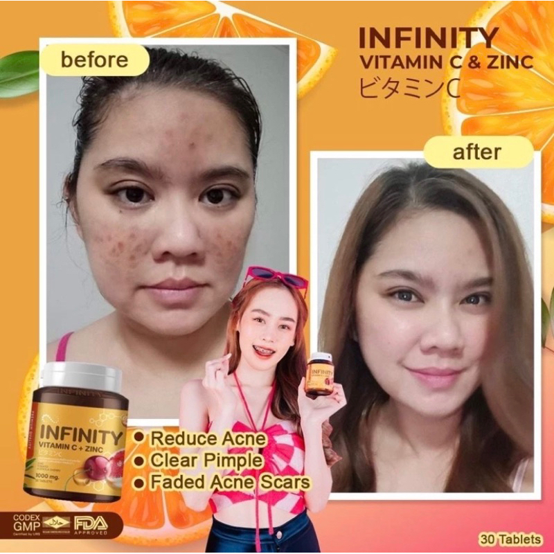 Jual GLUTA INFINITY VIT C PLUS ZINC ORIGINAL | Shopee Indonesia