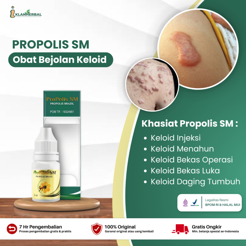 Jual Propolis SM Obat Keloid Daging Tumbuh Keloid Bekas Operasi Kloid