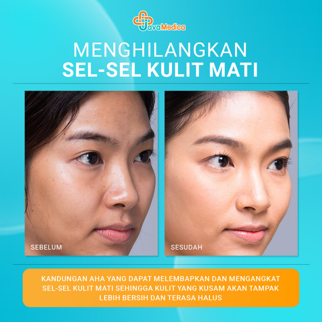 Jual Facial Wash AHA Java Medica- Sabun Pembersih & Mencerahkan Kulit ...