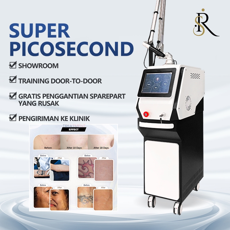 Jual Picosecond Laser Picoway Laser Wajah Alat Klinik Kecantikan Laser ...