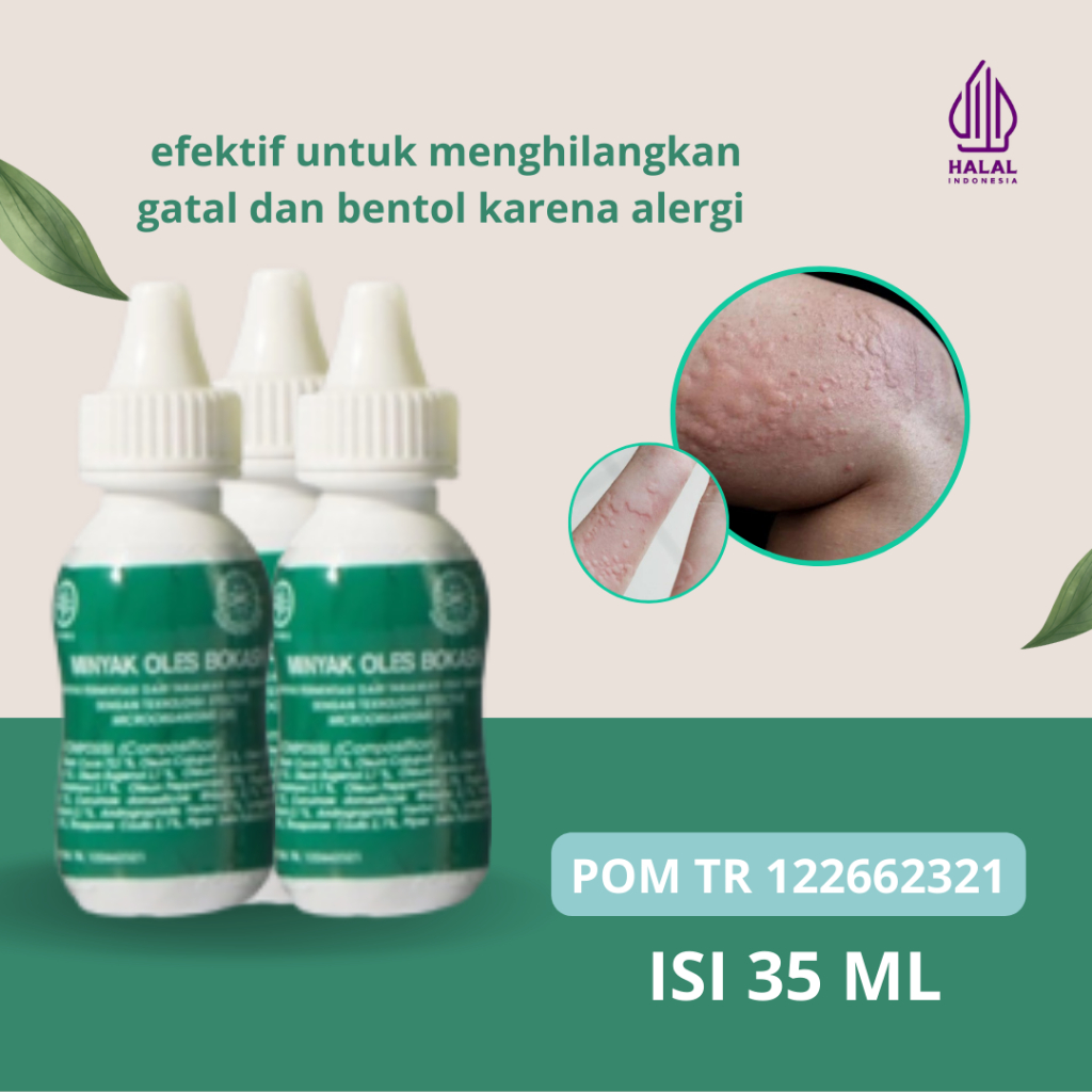 Jual Obat Biduran, Alergi, Menghilangkan Bentol-Bentol Dan Ruam Merah ...