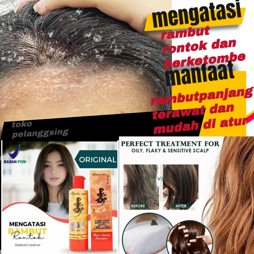 Jual shampoo anti ketombe penumbuh rambut sampo anti rontok penghilang