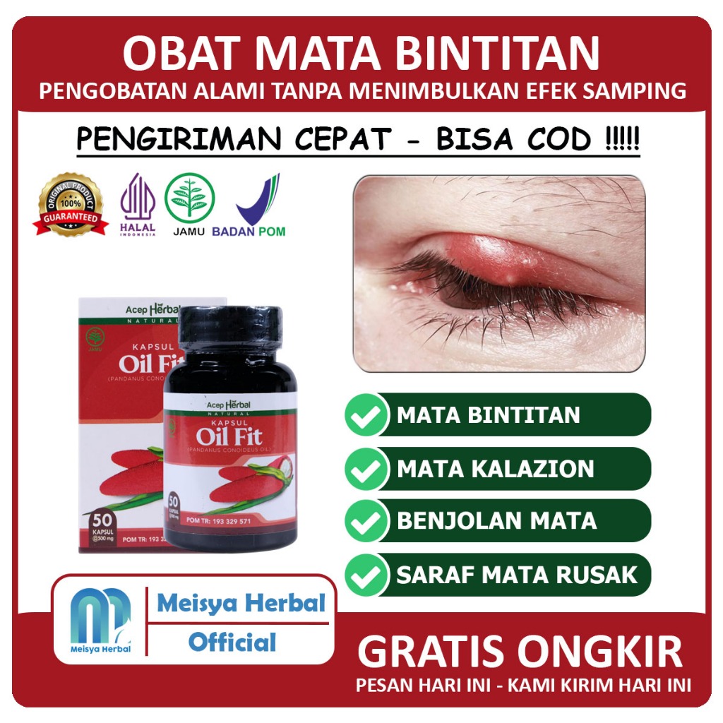 Jual Obat Benjolan Di Kelopak Mata Timbilan Mata Kalazion Bintitan