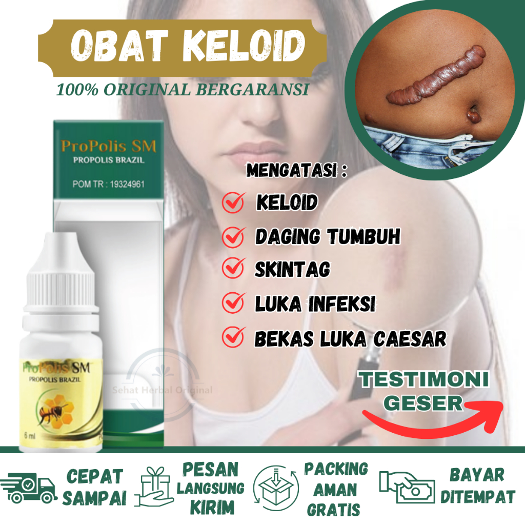 Jual Obat Keloid Bekas Caesar, Penghilang keloid Bekas Operasi, Obat ...