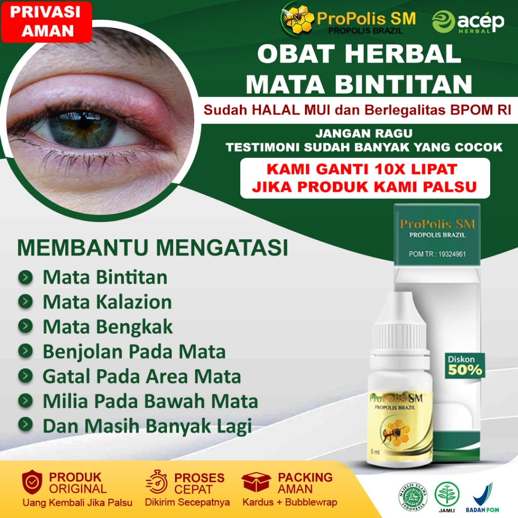 Jual Obat Mata Bintitan Mata Kalazion Bintitan Mata Mata Bengkak Gatal ...