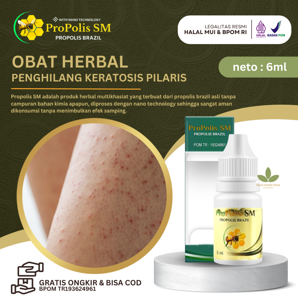 Jual Obat Penghilang Keratosis Pilaris Penyakit Kulit Ayam Obat