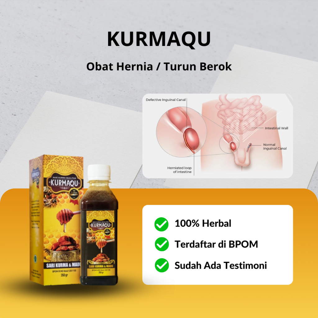 Jual Kurmaqu Obat Hernia Turun Berok Hernia Inguinalis Hernia