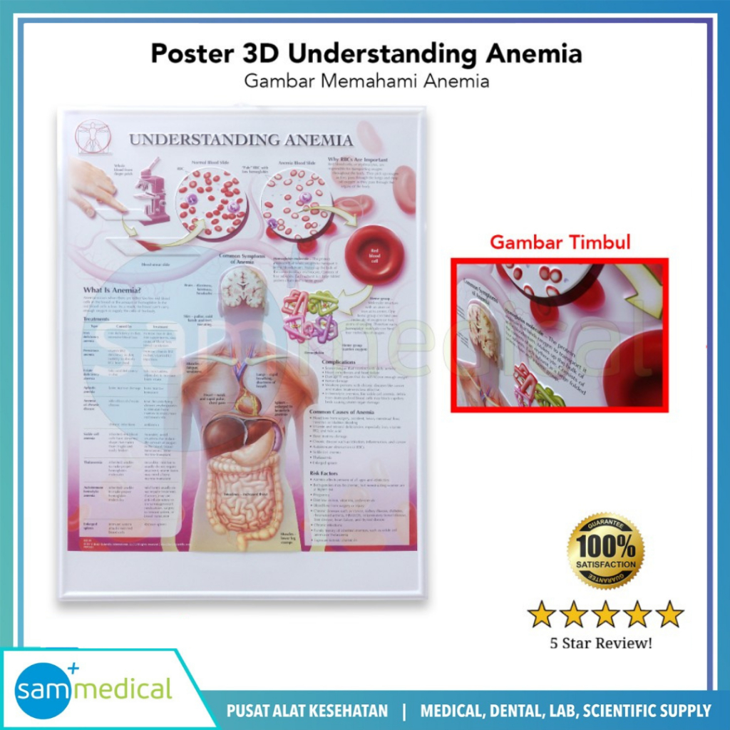 Jual Poster 3D Understanding Anemia / Poster Gambar Memahami Anemia BS ...