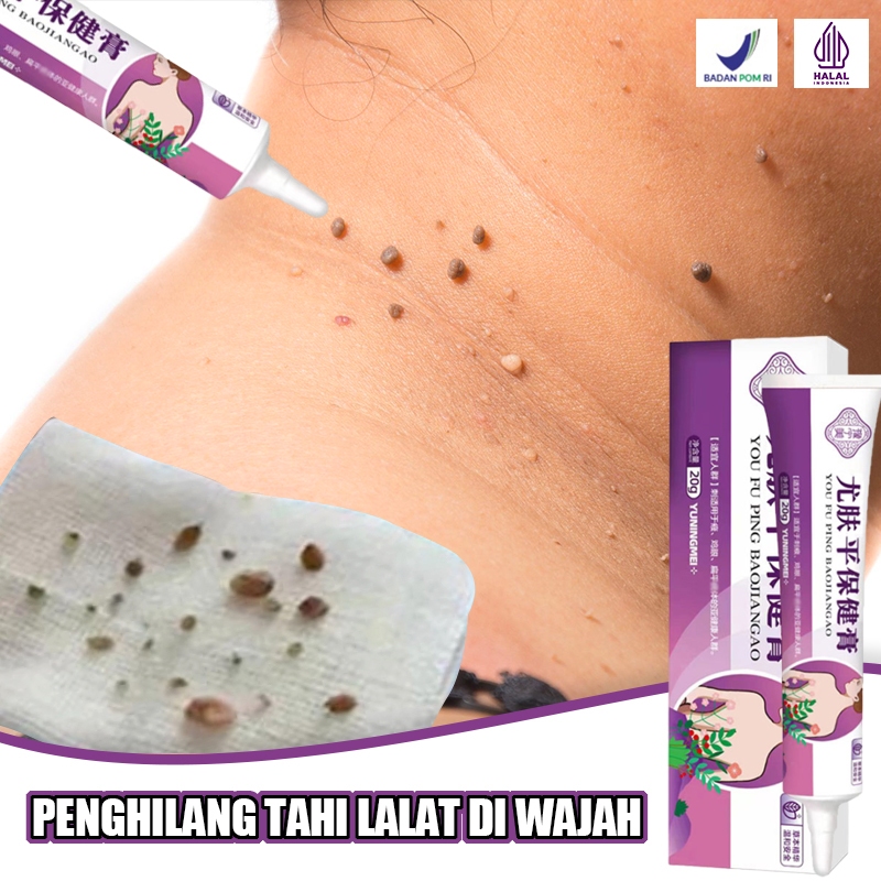 Jual Penghilang Tahi Lalat Di Wajah Penghilang Kutil Dan Tahi Lalat Obat Kutil Paling Ampuh