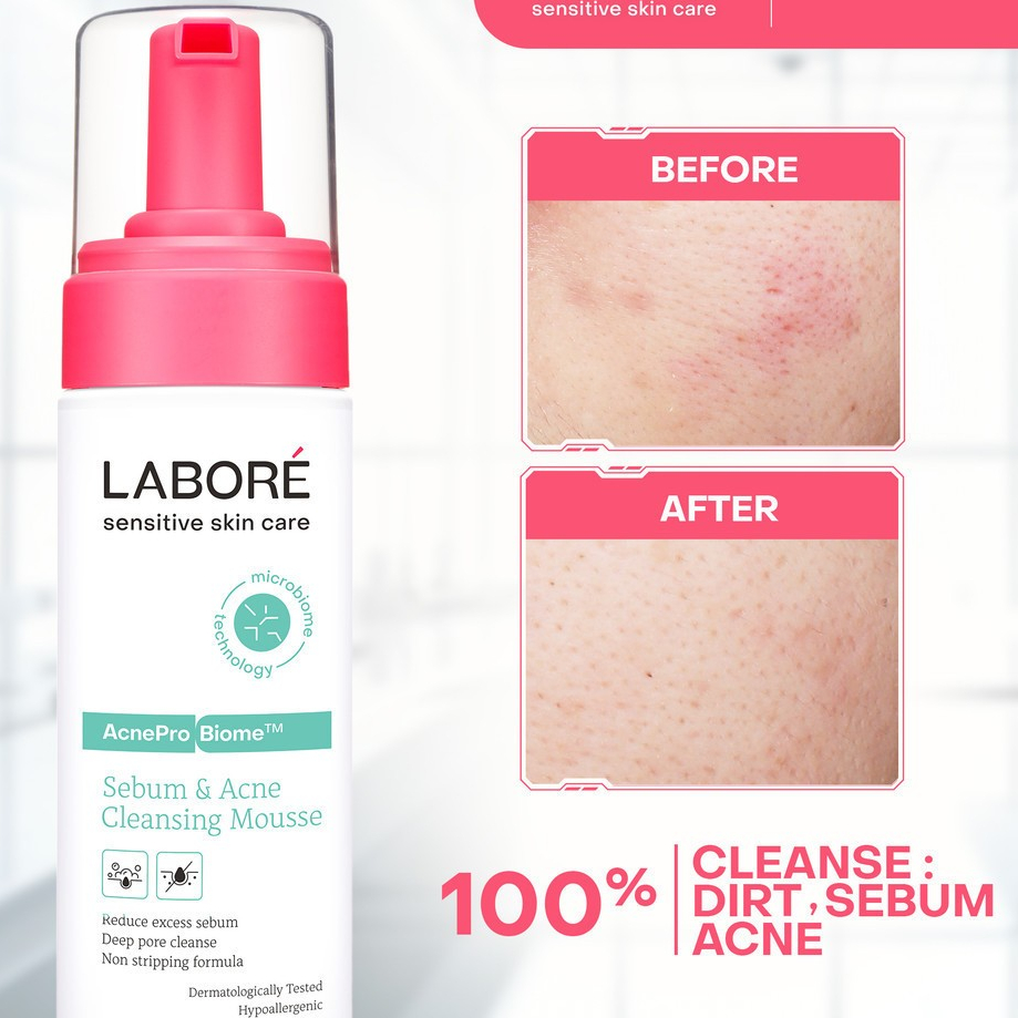 Jual [100% Original] Mini Labore AcnePro Biome Sebum & Acne Cleansing ...