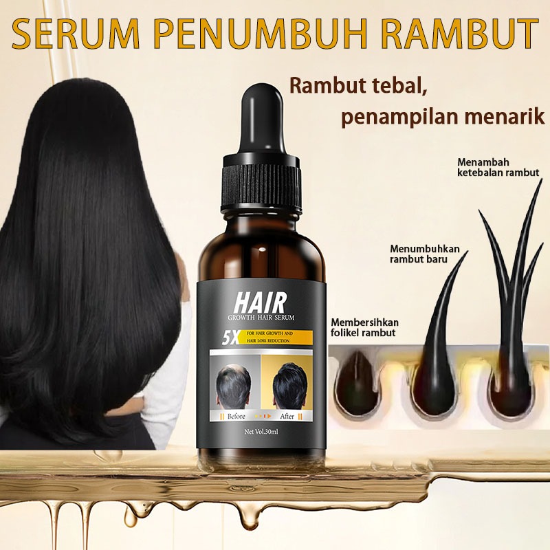 Jual Serum Pertumbuhan Rambut Anti Rontok Minyak Perawatan Rambut ...
