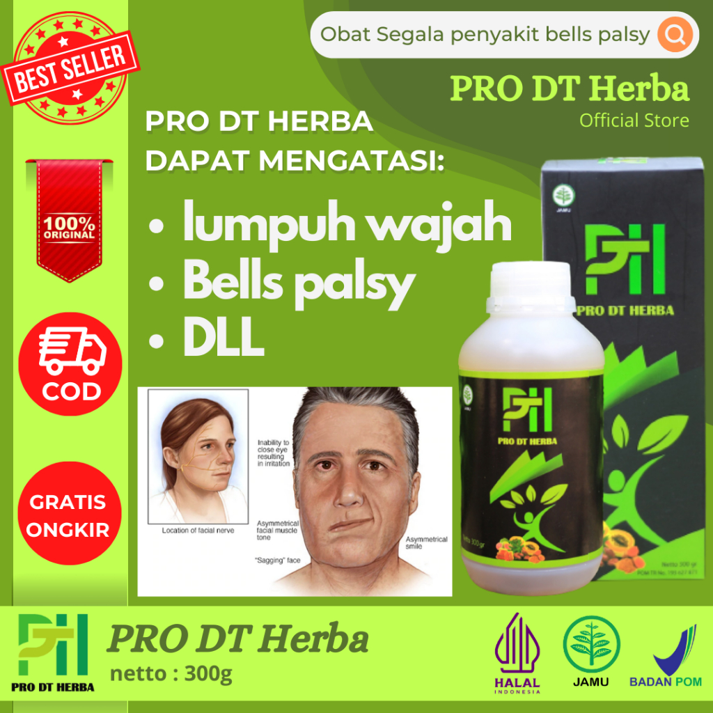 Jual Obat Bells Palsy Paling Ampuh, Mulut Miring Sebelah, Lumpuh Wajah ...