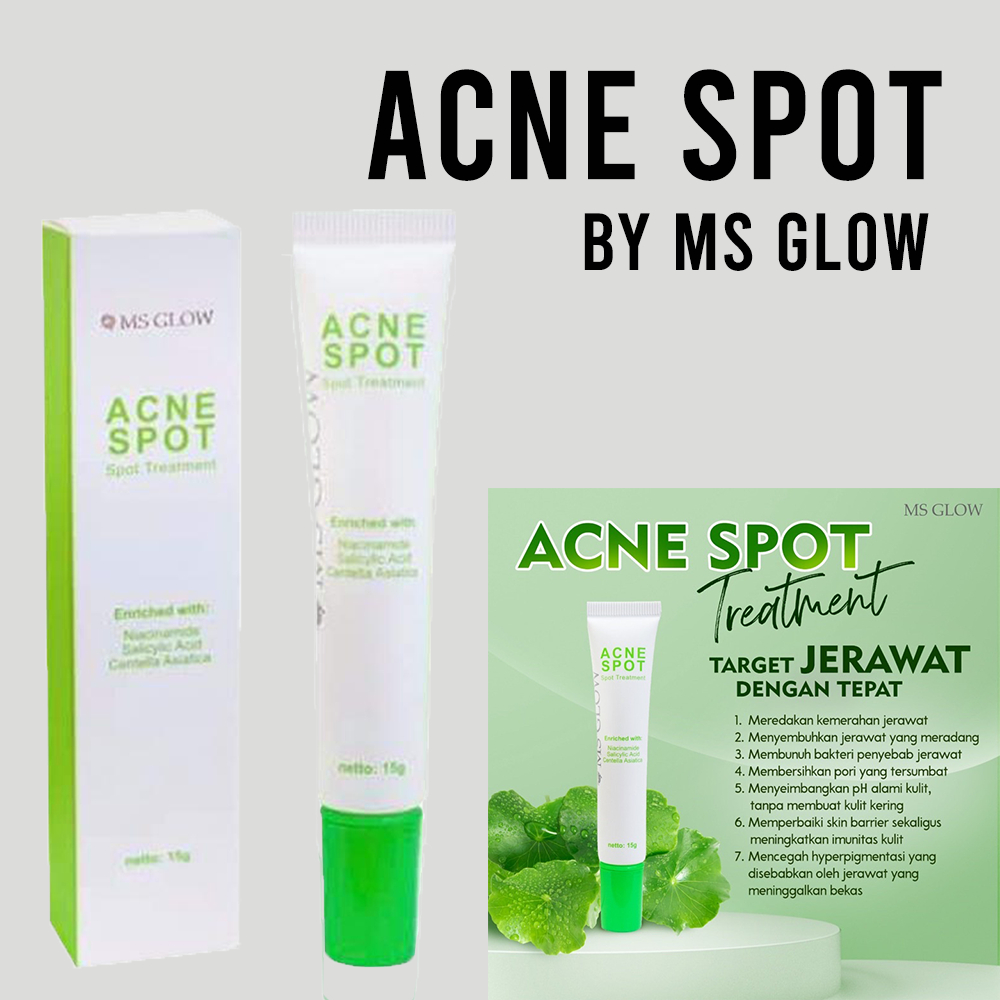 Jual Acne Spot Ms Glow Original Obat Totol Jerawat Spot Treatment. Shopee Indonesia