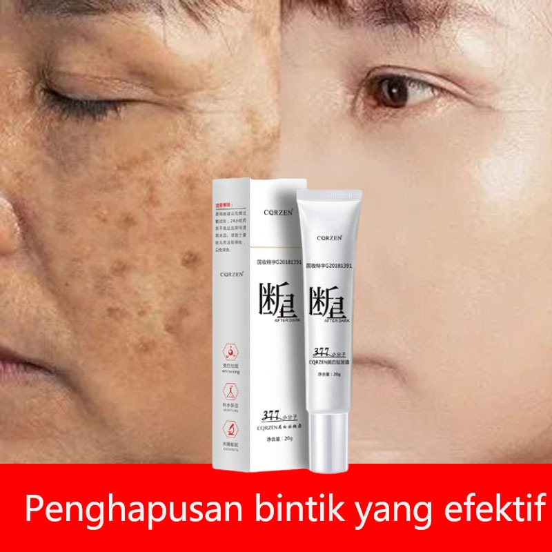 Jual Salep Flek Hitam Membandel Cream Penghilang Flek Hitam Penghilang ...