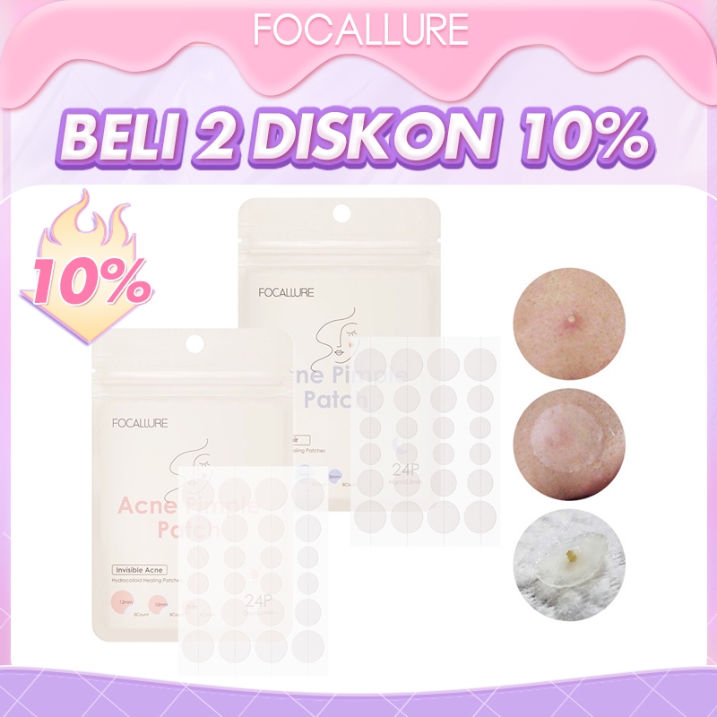 Jual Focallure Day Night Spot Patch Acne Treatment Waterproof Super