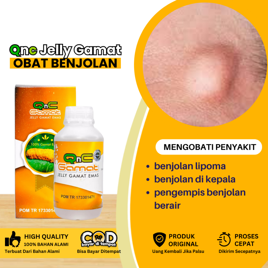 Jual Obat Benjolan, Obat Benjolan Lipoma, Obat Benjolan Di Kepala, Obat ...