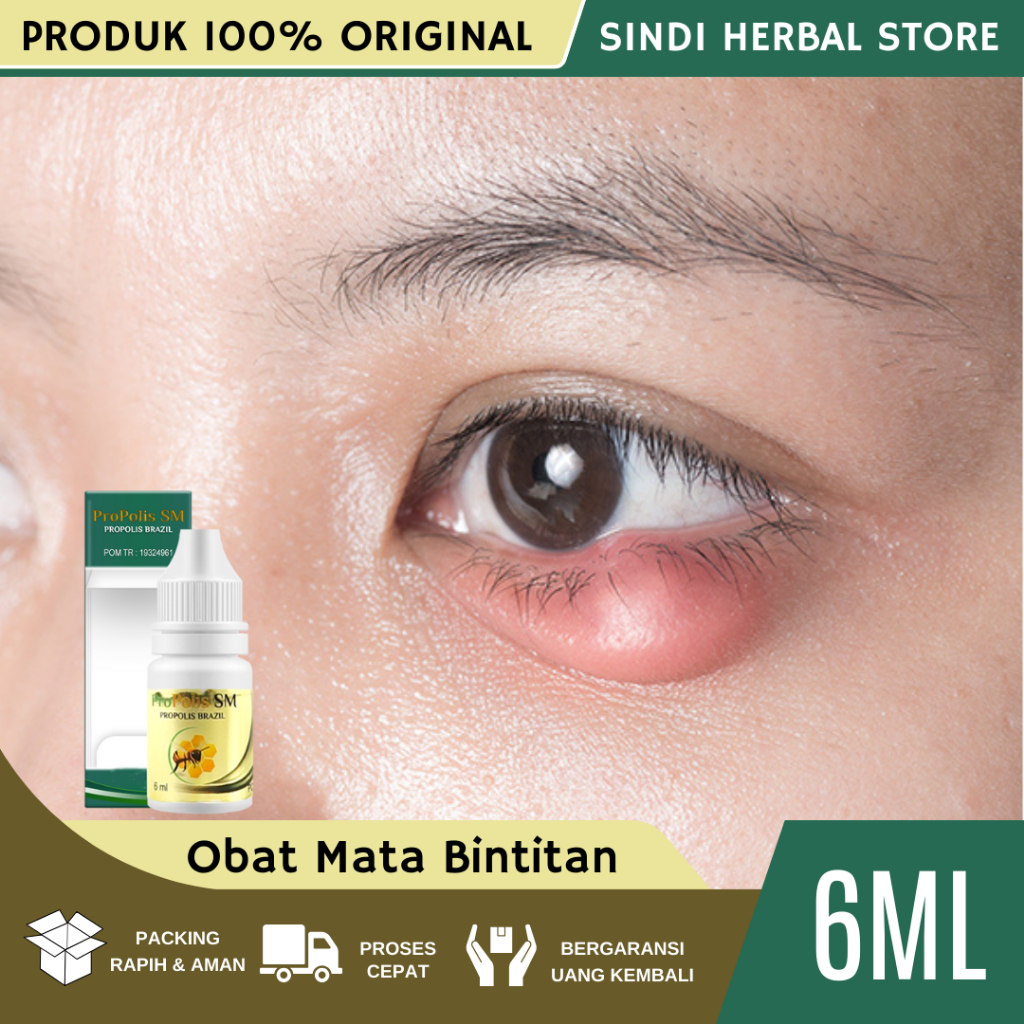 Jual Obat Mata Bintitan, Obat Kempeskan Bintitan, Obat Mata Bintitan ...