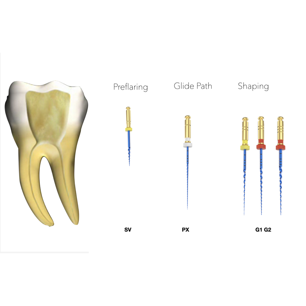 Jual Profa Dental Eli Endo Rotary File Blue Endofile Mg3 Perfect Lentur ...