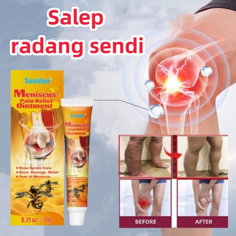 Jual Meniscus pain relief ointment Obat Sakit Lutut Salep asam urat  mengatasi nyeri lutut sendi Bunion pain relief cream Arthritis cream Pain  Relief Cream | Shopee Indonesia