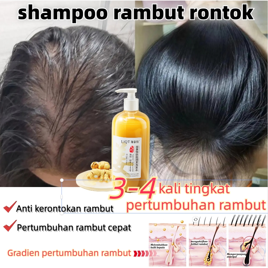 Jual Rambut rontok Shampoo penumbuh rambut cepat shampoo rontok dan ...