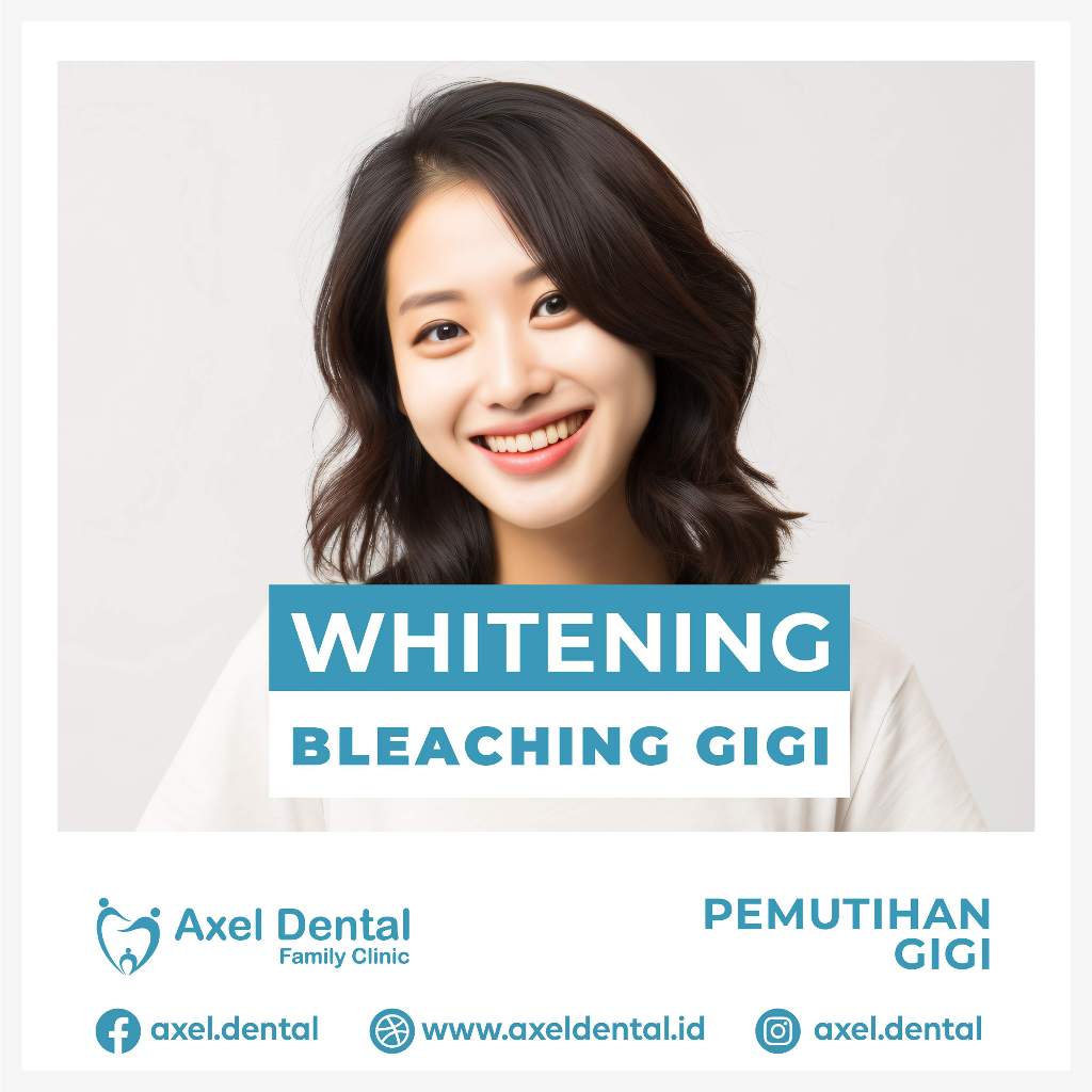 Jual Voucher Whitening Gigi / Bleaching / Gigi Putih Natural AXEL ...