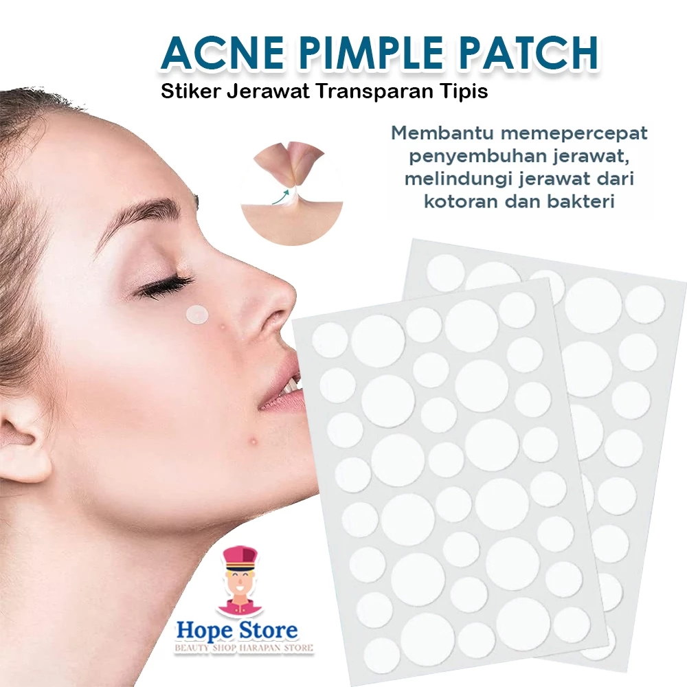 Acne Pimple Patch Isi 36pcs / Sticker Tape Penghilang Jerawat | AutoStock