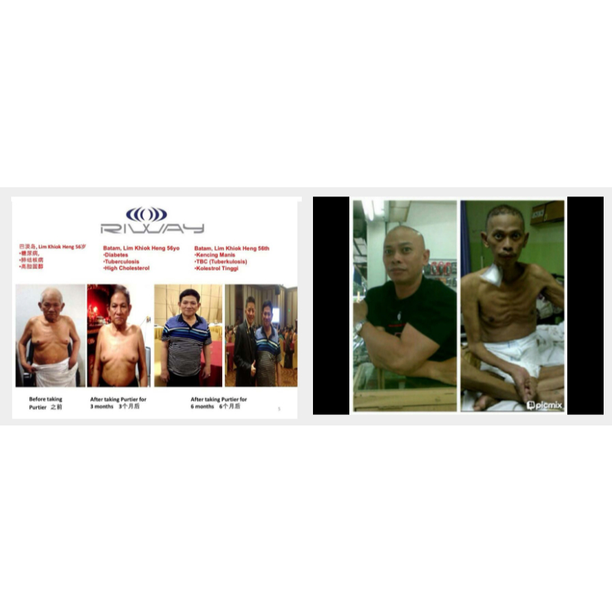 Jual BEST PURTIER PLASENTA EDISI 7 ORIGINAL PUTIER PURTIR Purtier ...