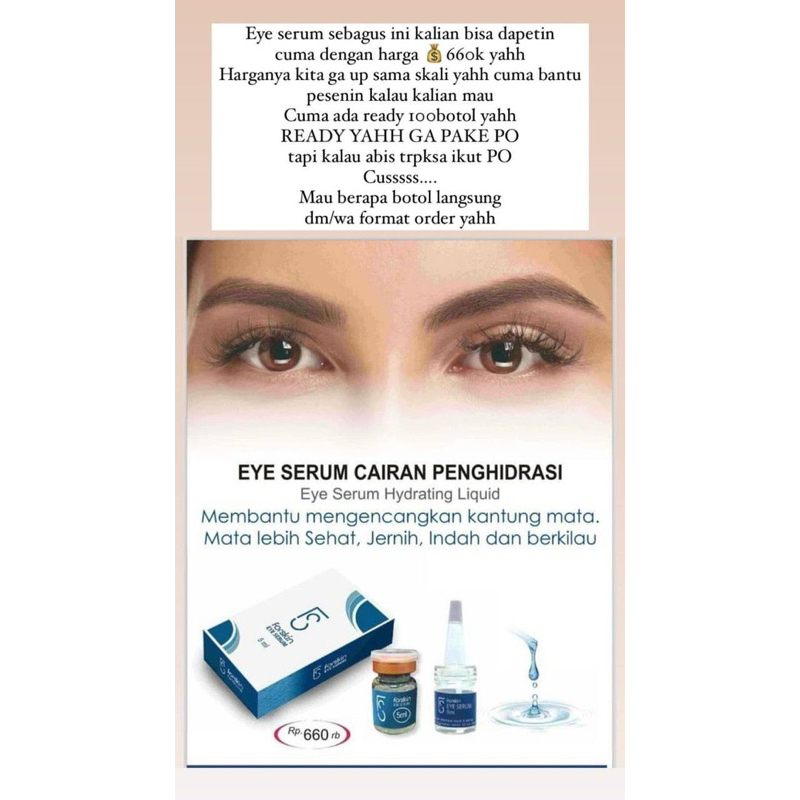Jual Aii Vision Untuk Mata Minus, Rabun, Katarak, Glaukoma Akut karena ...