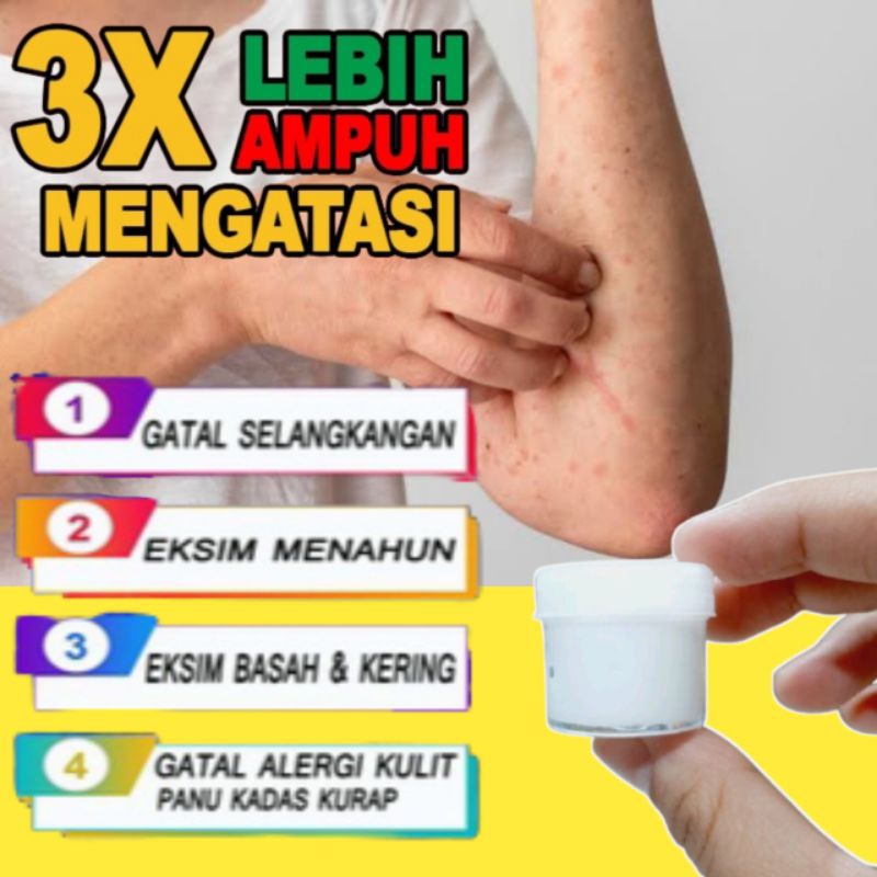 Jual Salep Serbaguna Racikan Apotek Untuk Segala Penyakit Gatal Shopee Indonesia