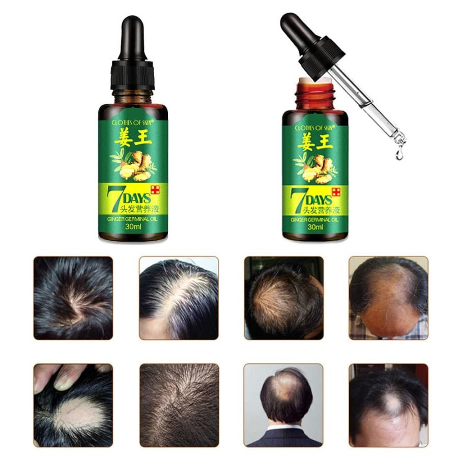 Jual Clothes of Skin 7 Days Minyak Penumbuh dan Perawatan Rambut Ginger