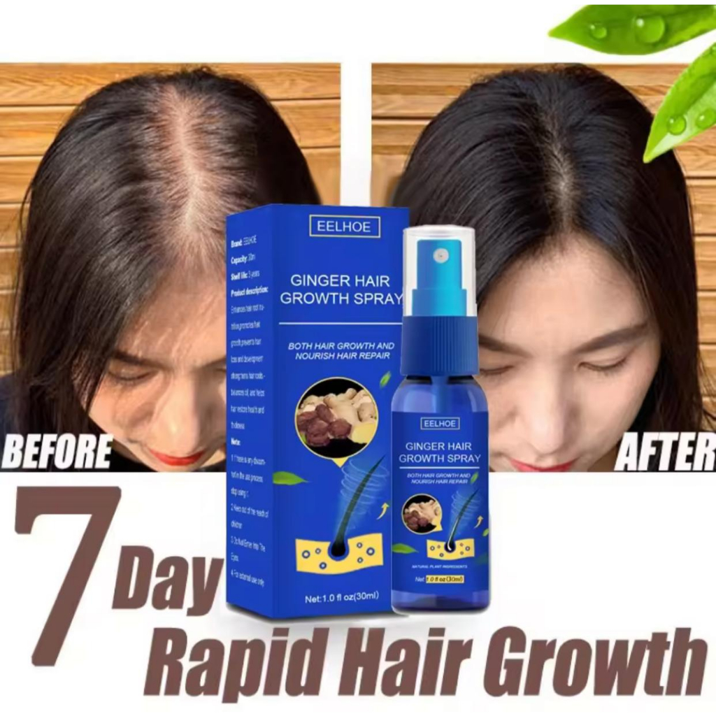 Jual EELHOE Hair Growth Spray Penumbuh Rambut Wanita Pria Secara Cepat
