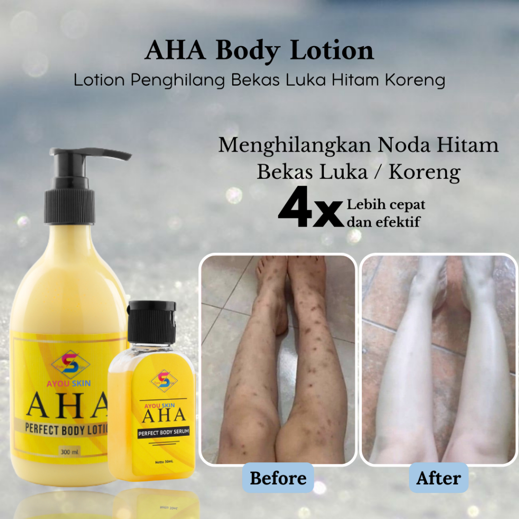 Jual [COD] AHA Body Lotion By AYOUSKIN Krim Penghilang / Menghilangkan Bekas Luka Hitam Koreng
