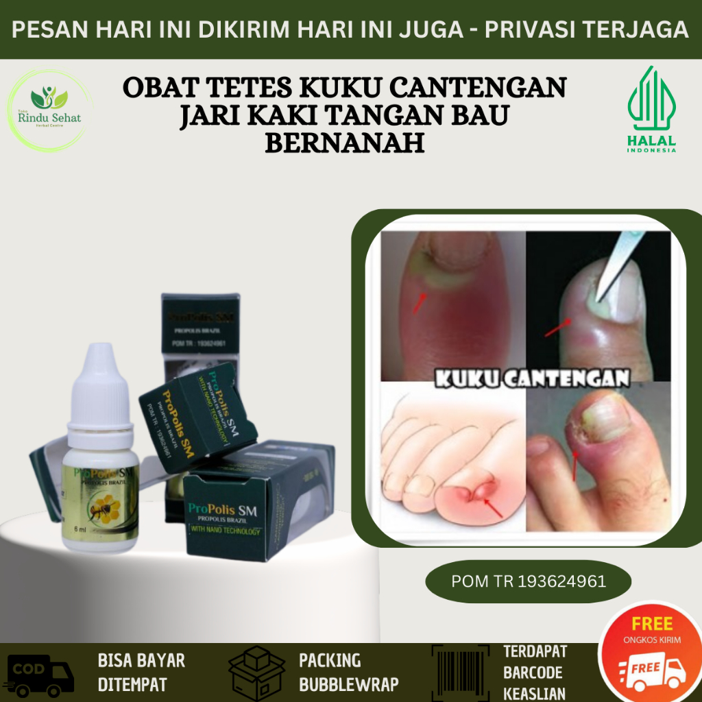 Jual Obat Tetes Cantengan Jempol Kaki Dan Tangan Kuku Rusak Gatal Sakit