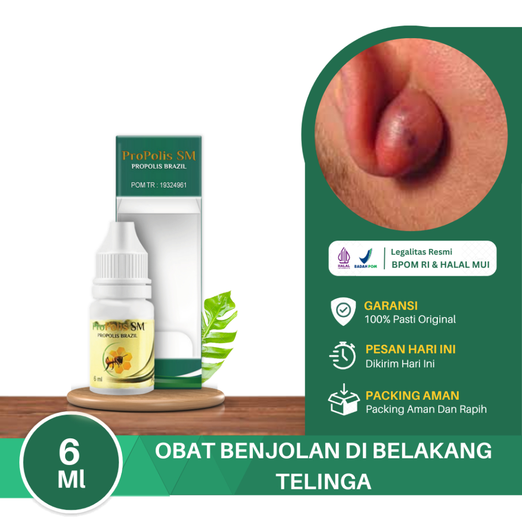Jual Obat Benjolan Di Belakang Telinga, Benjolan Di Daun Telinga