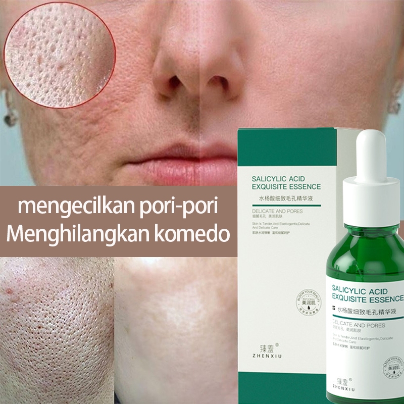 Jual Penghilang Komedo Hidung Serum Pori Pori Besar Serum Pengecil ...