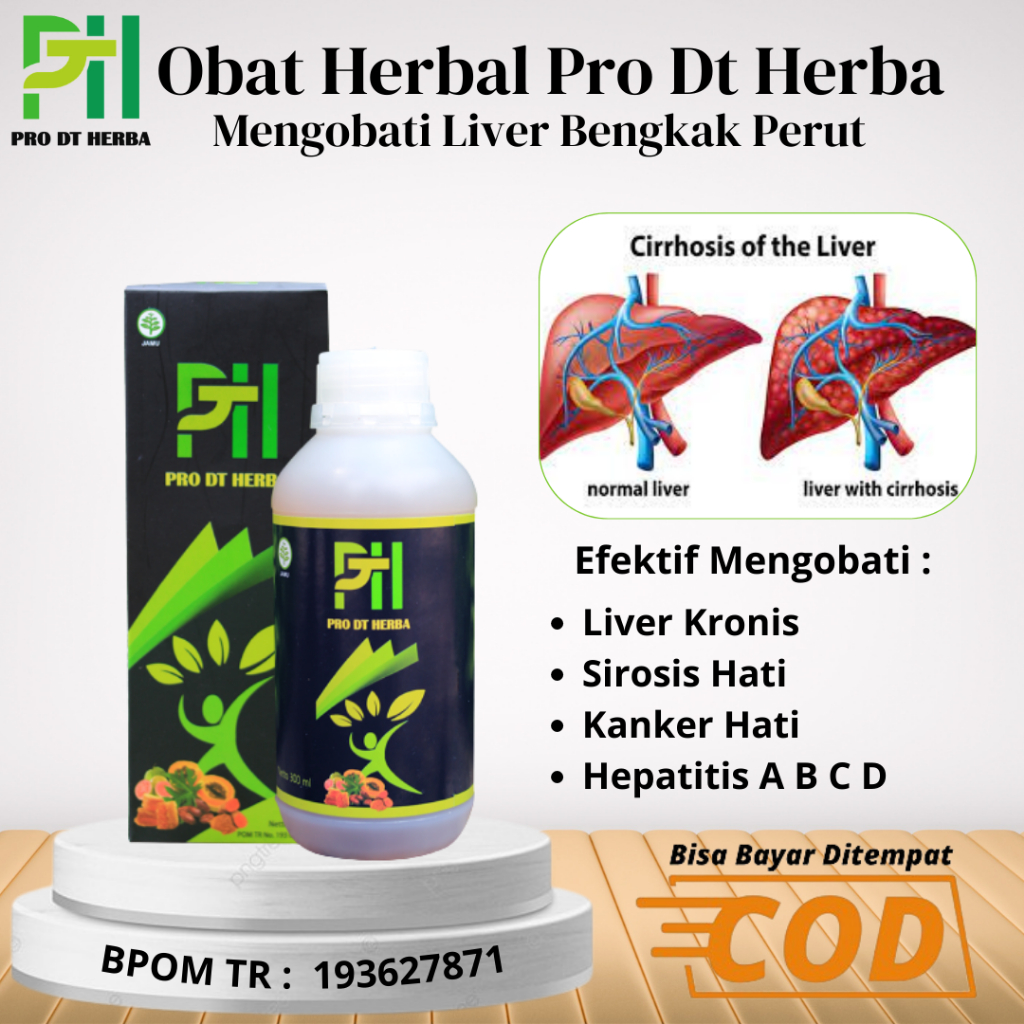 Jual Obat Liver Perut Bengkak Paling Ampuh - Hepatitis A B C D - Sirois ...