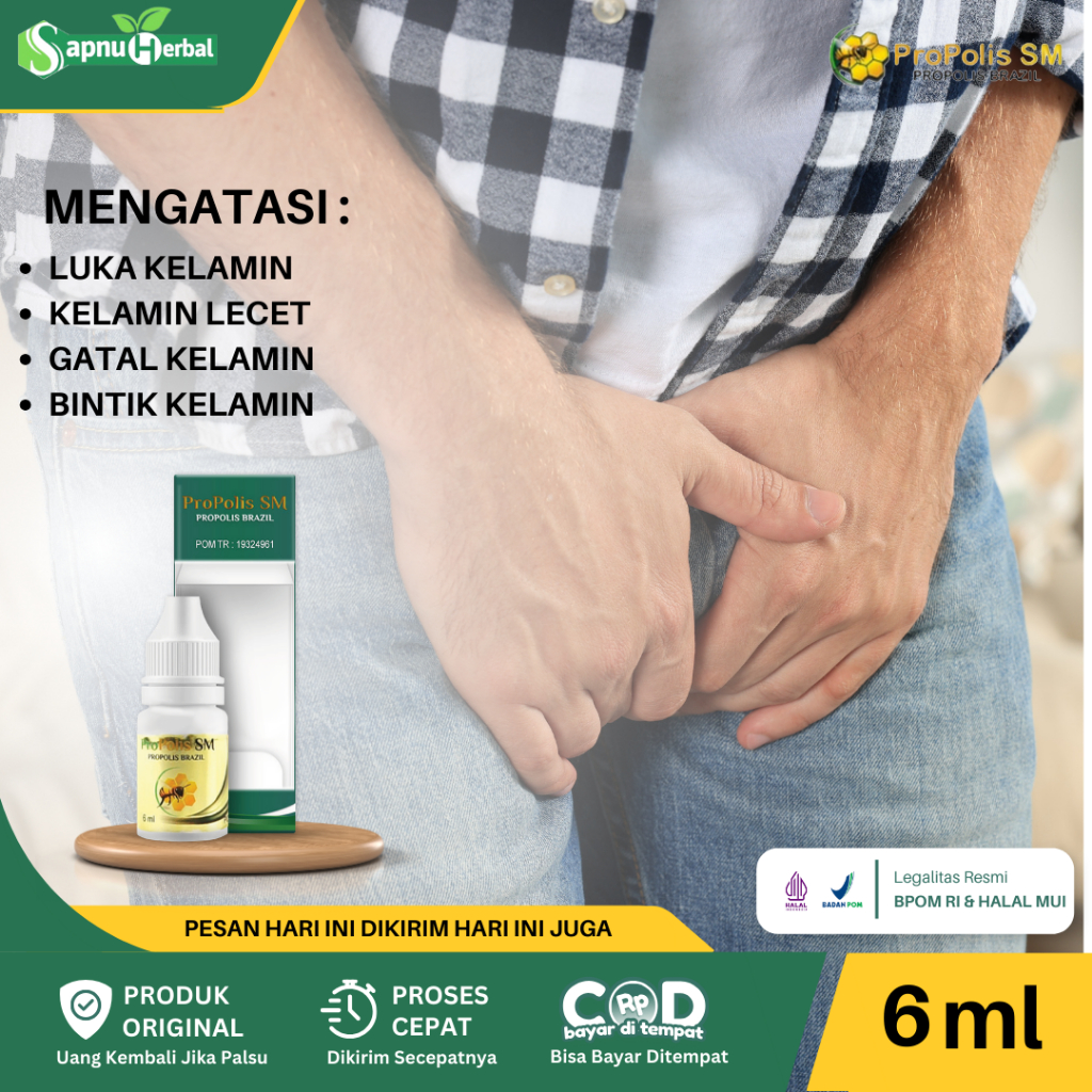 Obat Luka Pada Kelamin Pria, Obat Perih Luka Di Kelamin Pria, Obat Kelamin Lecet, Obat Penis Lecet, Obat Gatal Dan Perih Di Kelamin, Obat Penis Bentol, Gatal Mr P, Penis Bintik Bintik,Obat Herpes Genital, Iritasi Kulit Kelamin Dengan ProPolis SM