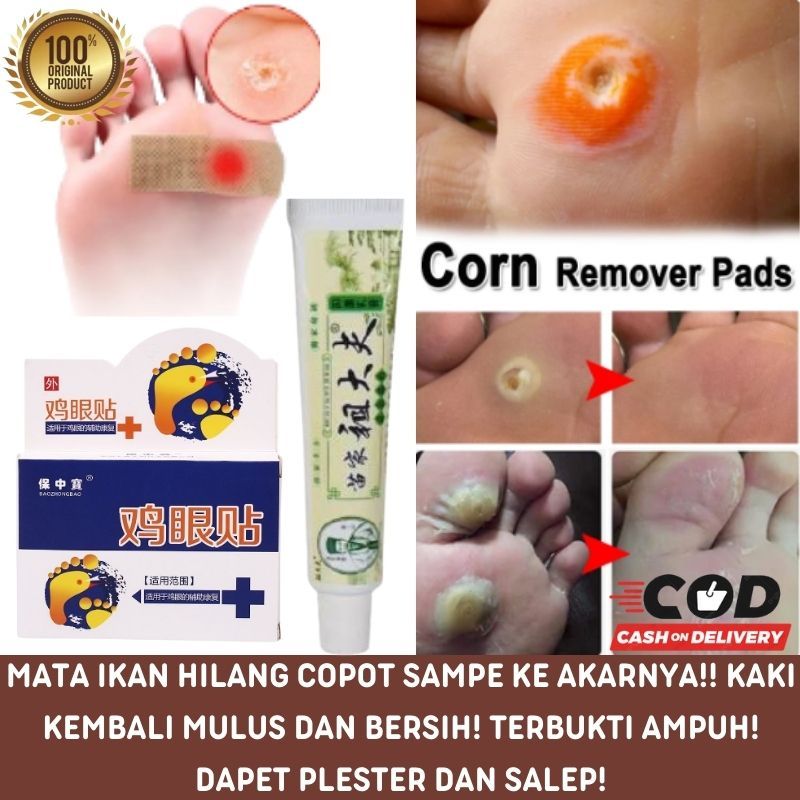 Jual Foot Corn Plester Mata Ikan Kapalan Super Shopee Indonesia