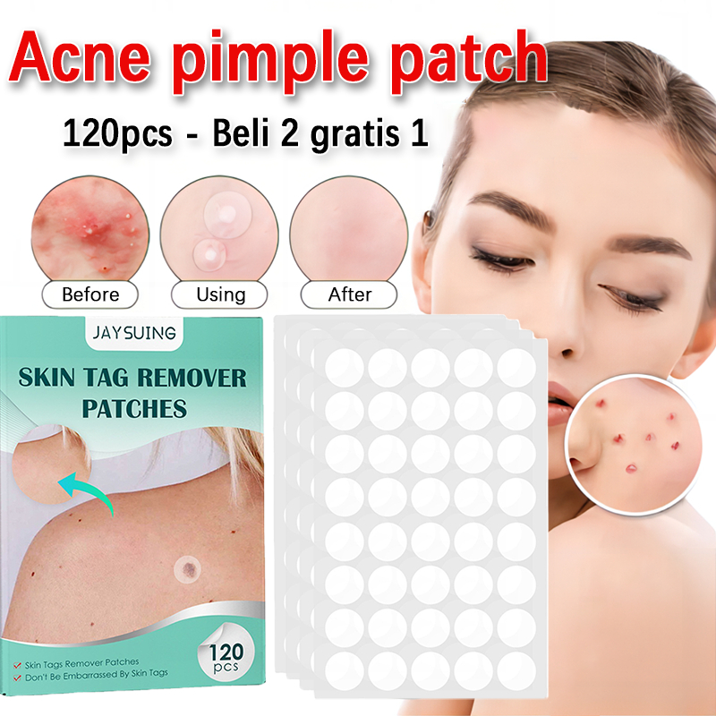 Jual Penghilang Jerawat Sticker Invisible Bercak Jerawat Kempes Pimple ...