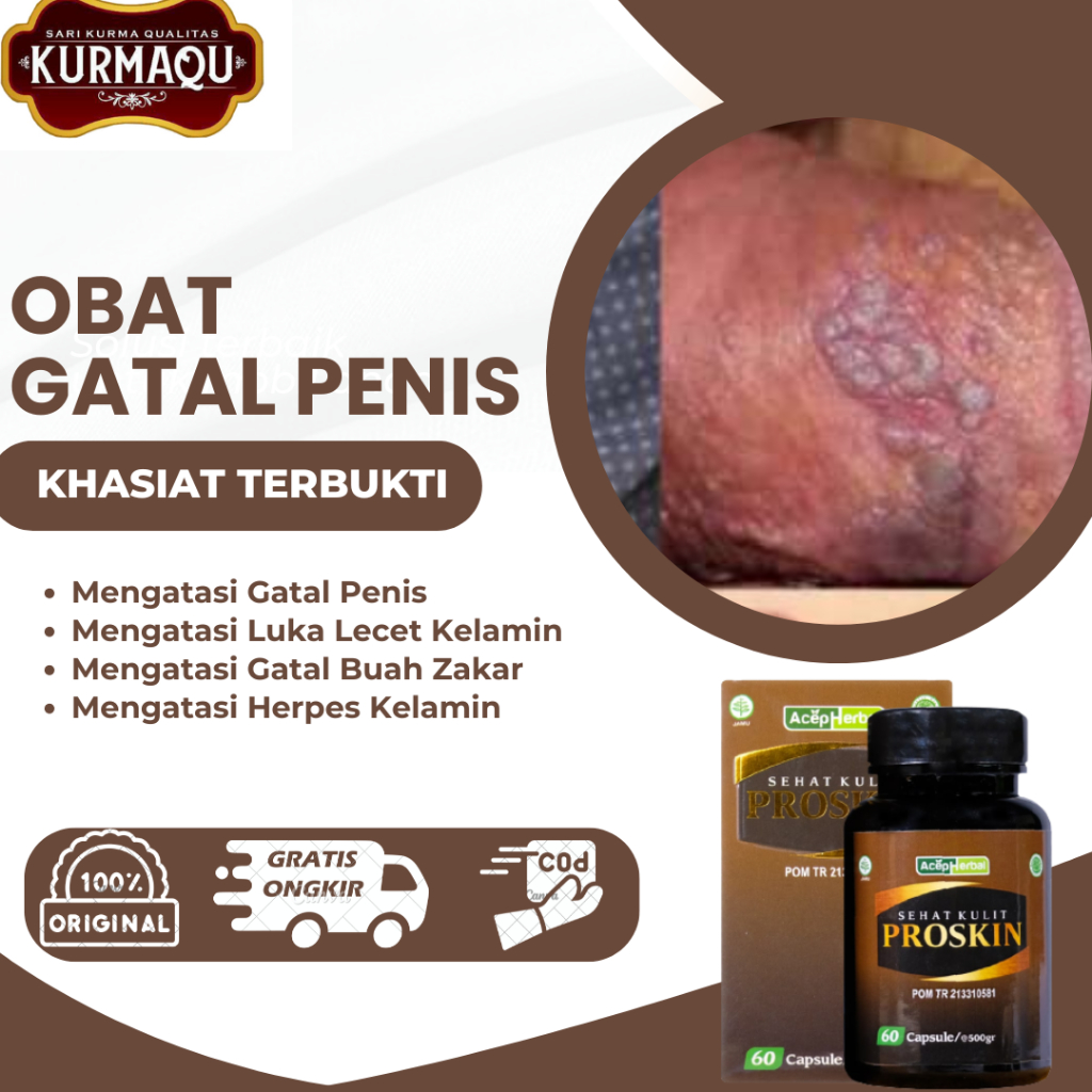 Penis uchun kapsulalar