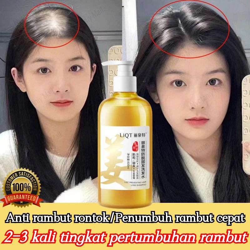 Jual Shampoo rambut rontok Shampoo penumbuh rambut cepat Sampo ...